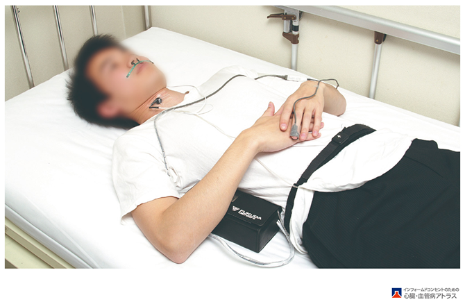 SAS検査の様子写真